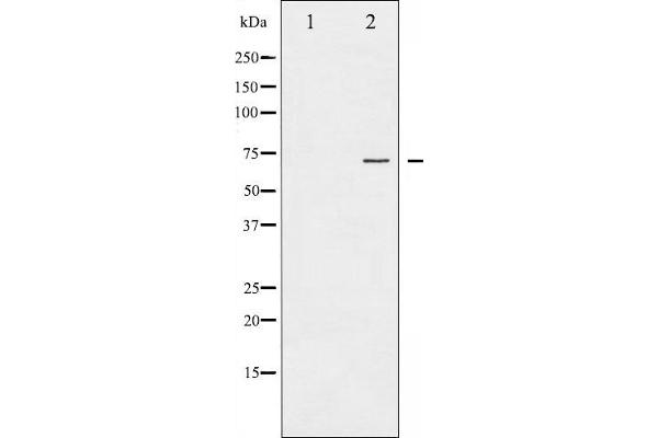 PKC zeta Antikörper  (pThr410)
