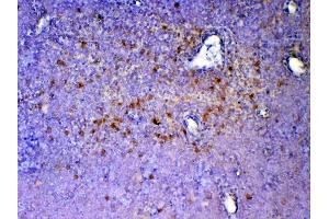 IHC analysis of ICOS using anti-ICOS antibody . (ICOS anticorps  (AA 21-200))
