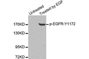 Western blot analysis of extracts from A431 cells, using Phospho-EGFR-Y1172 antibody. (EGFR anticorps  (pTyr1172))