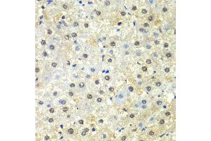 Immunohistochemistry of paraffin-embedded human liver injury using PSMD13 antibody.
