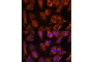 Immunofluorescence analysis of C6 cells using INPP5E antibody (ABIN7267883) at dilution of 1:100.