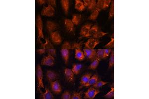 Immunofluorescence analysis of C6 cells using INPP5E antibody (ABIN7267883) at dilution of 1:100. (INPP5E anticorps  (AA 510-630))