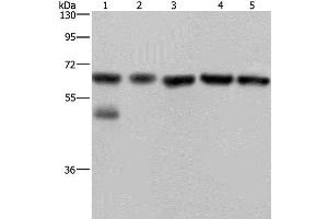 Western Blot analysis of Jurkat cell and Human brain malignant glioma tissue, PC3, K562 and A549 cell using NUP62 Polyclonal Antibody at dilution of 1:300 (NUP62 anticorps)