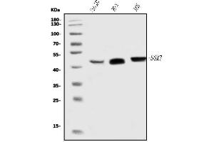 Western blot analysis of SOX7 using anti-SOX7 antibody (ABIN7602064).