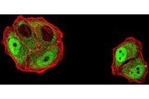 Immunofluorescence analysis of Hela cells using DDX1 mouse mAb (green). (DDX1 anticorps  (AA 642-740))