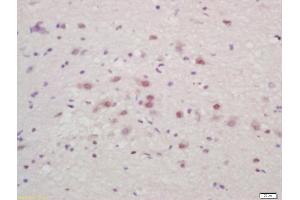 Formalin-fixed and paraffin embedded mouse brain labeled with Anti-ZNF231 Polyclonal Antibody, Unconjugated (ABIN727145) at 1:200 followed by conjugation to the secondary antibody and DAB staining (Bassoon anticorps  (AA 2901-3000))