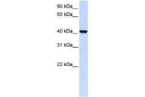 WB Suggested Anti-DGAT2L4 Antibody Titration:  0. (AWAT2 anticorps  (C-Term))