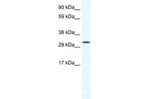 Western Blotting (WB) image for anti-SRY (Sex Determining Region Y)-Box 12 (SOX12) antibody (ABIN2460695) (SOX12 anticorps)