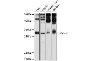 Western blot analysis of extracts of various cell lines, using EMG1 antibody (ABIN1875902) at 1:1000 dilution. (EMG1 anticorps)