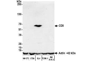 Western Blotting (WB) image for anti-CD5 (CD5) (AA 445-495) antibody (ABIN7454003) (Recombinant CD5 anticorps  (AA 445-495))