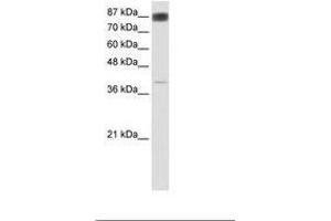 Image no. 1 for anti-Nuclear Factor of Activated T-Cells, Cytoplasmic, Calcineurin-Dependent 4 (NFATC4) (AA 241-290) antibody (ABIN6736168) (NFATC4 anticorps  (AA 241-290))