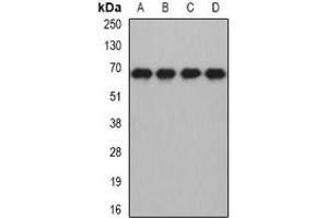 Western blot analysis of MTF-2 expression in HL60 (A), HepG2 (B), mouse brain (C), rat brain (D) whole cell lysates. (MTF2 anticorps)