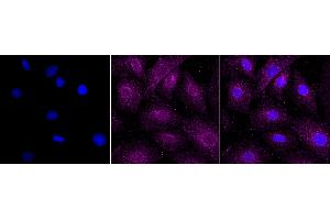 anti-RAB22A, Member RAS Oncogene Family (RAB22A) antibody