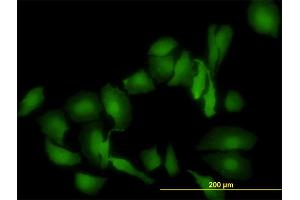 Immunofluorescence of monoclonal antibody to LGALS1 on HeLa cell. (LGALS1/Galectin 1 anticorps  (AA 1-135))