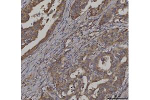 IHC analysis of FATP3/SLC27A3 using anti-FATP3/SLC27A3 antibody (ABIN7600438). (SLC27A3 anticorps  (AA 192-683))