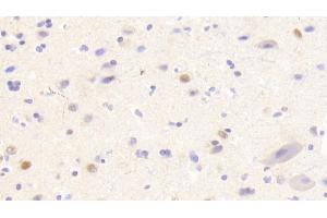 Detection of ANP32A in Human Cerebrum Tissue using Polyclonal Antibody to Acidic Nuclear Phosphoprotein 32 Family, Member A (ANP32A)