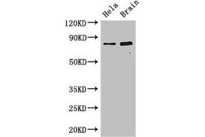 Western Blot Positive WB detected in: Hela whole cell lysate, Mouse brain tissue All lanes: DACH1 antibody at 2. (ING3 anticorps  (AA 51-223))