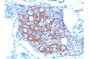 Formalin-fixed, paraffin-embedded human Pancreas stained with CD56 Monoclonal Antibody (SPM128)