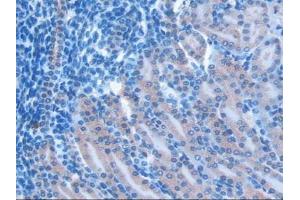 Detection of RSPO1 in Mouse Kidney Tissue using Polyclonal Antibody to R-Spondin 1 (RSPO1)