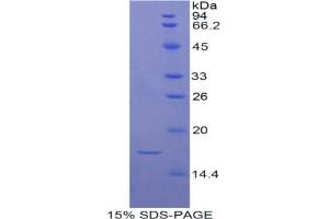 SDS-PAGE analysis of Rat ADAMTS7 Protein.