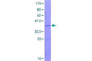 Image no. 1 for Ribosomal Protein L35a (RPL35A) (AA 1-110) protein (GST tag) (ABIN1318622)