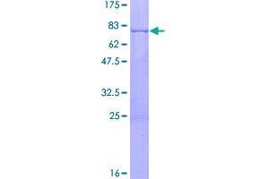 Platelet-Derived Growth Factor C (PDGFC) (AA 1-345) protein (GST tag)