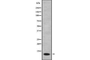 Western blot analysis FXYD2 using COLO205 whole cell lysates (FXYD2 anticorps  (Internal Region))