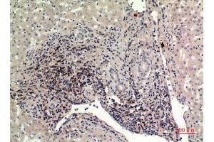 Immunohistochemistry (IHC) analysis of paraffin-embedded Human Liver, antibody was diluted at 1:100. (IFITM1 anticorps  (N-Term))