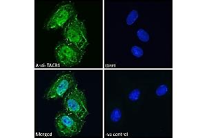 (ABIN190795) Immunofluorescence analysis of paraformaldehyde fixed Neuro2a cells, permeabilized with 0. (TACR1 anticorps  (Internal Region))
