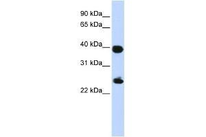WB Suggested Anti-H2AFY Antibody Titration: 0. (H2AFY anticorps  (Middle Region))