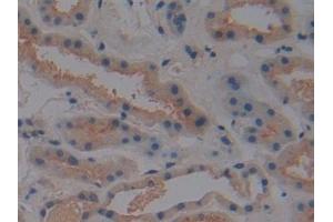 Detection of DBP in Human Kidney Tissue using Polyclonal Antibody to Vitamin D Binding Protein (DBP)