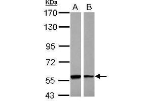 WB Image Sample (30 ug of whole cell lysate) A: A431 B: Raji 7. (PHGDH anticorps)