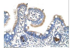 Image no. 1 for anti-Ring Finger Protein 39 (RNF39) (AA 21-70) antibody (ABIN6736652)