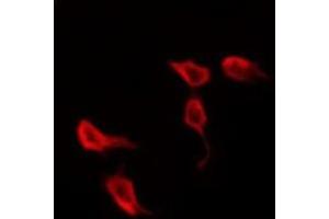 ABIN6278696 staining Hela by IF/ICC. (VZV Protein kinase ORF47 anticorps)