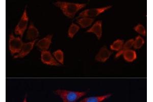 Immunofluorescence analysis of HeLa cells using HO-1 Polyclonal Antibody at dilution of 1:100 (40x lens).