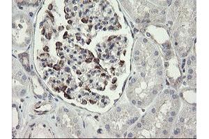 Image no. 4 for anti-Methionyl Aminopeptidase 2 (METAP2) (AA 2-212) antibody (ABIN1491153) (METAP2 anticorps  (AA 2-212))