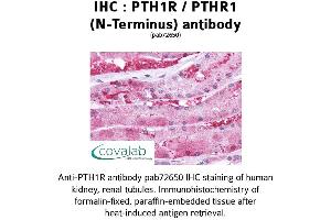 Image no. 1 for anti-Parathyroid Hormone 1 Receptor (PTH1R) (Extracellular Domain), (N-Term), (pThr1) antibody (ABIN1738580) (PTH1R anticorps  (Extracellular Domain, N-Term, pThr1))