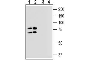 anti-Sodium Hydrogen Exchanger 7 (SLC9A7) (AA 158-171), (Extracellular) antibody