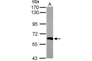 Western Blot analysis: AP19061PU-N PPP3CB antibody staining of Mouse Brain whole cell lysate, 7. (PPP3CB anticorps)
