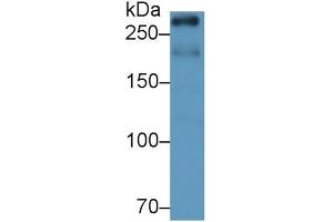 Detection of mTOR in Rat Cerebrum lysate using Monoclonal Antibody to Serine/threonine-protein kinase mTOR (mTOR) (MTOR anticorps  (AA 2226-2488))