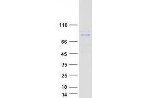 Validation with Western Blot (RHOBTB1 Protein (Transcript Variant 1) (Myc-DYKDDDDK Tag))
