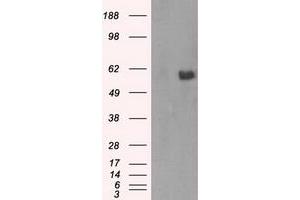 Image no. 3 for anti-V-Akt Murine Thymoma Viral Oncogene Homolog 2 (AKT2) antibody (ABIN1496564) (AKT2 anticorps)