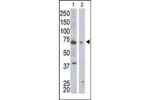 The anti-GGA1 Pab (ABIN389018 and ABIN2839239) is used in Western blot to detect GGA1 in mouse kidney tissue lysate (lane 1) and Jurkat cell lysate (lane 2).