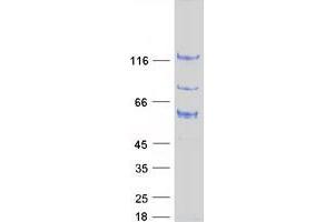 Validation with Western Blot