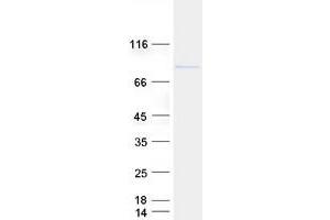 Validation with Western Blot