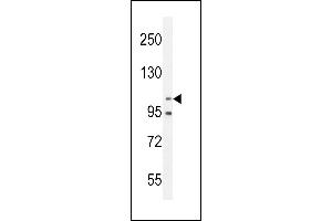 Nephrin  antibody (ABIN654375 and ABIN2844129) western blot analysis in MDA-M cell line lysates (35 μg/lane).