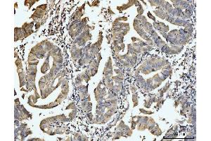 IHC analysis of EXOSC8 using anti-EXOSC8 antibody (ABIN7601850). (EXOSC8 anticorps  (AA 49-216))