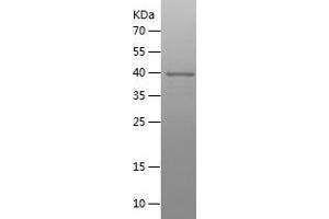 Western Blotting (WB) image for Protein Disulfide Isomerase Family A, Member 3 (PDIA3) (AA 340-505) protein (His-IF2DI Tag) (ABIN7124644)