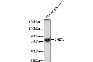 Western blot analysis of extracts of mouse pancreas, using CHID1 antibody (ABIN7266330) at 1:1000 dilution.