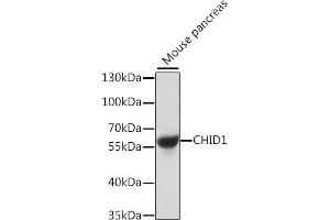 Western blot analysis of extracts of mouse pancreas, using CHID1 antibody (ABIN7266330) at 1:1000 dilution. (CHID1 anticorps  (AA 1-393))
